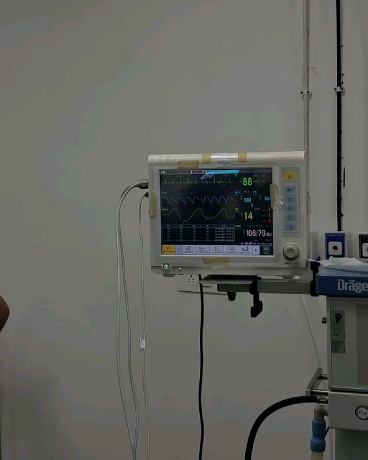 ECG machine and medical equipment asset tracking